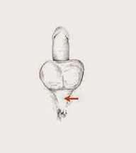 Strengthening muscles and their tension to increase strength